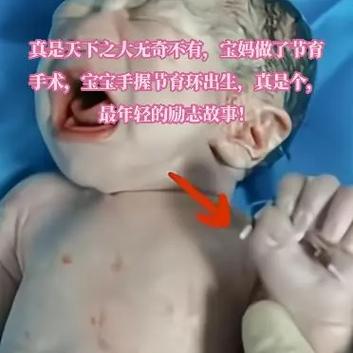 我的出生真的是件好事吗图标