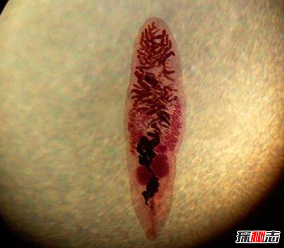 寄生虫从胸口寄生